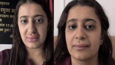 मां-बेटे ने खाया वंदे भारत एक्सप्रेस का खाना, महिला के सूजे होंठ; बेटे की स्थिति हुई गंभीर